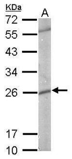 GSTP1 Antibody in Western Blot (WB)