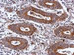 ITGB1 Antibody in Immunohistochemistry (Paraffin) (IHC (P))