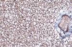 ITGB1 Antibody in Immunohistochemistry (Paraffin) (IHC (P))