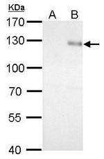 ITGB1 Antibody in Western Blot (WB)