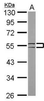 Cytokeratin 8 Antibody in Western Blot (WB)