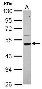 Cytokeratin 14 Antibody in Western Blot (WB)