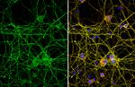 Tau Antibody in Immunocytochemistry (ICC/IF)