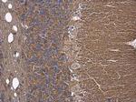 Tau Antibody in Immunohistochemistry (Paraffin) (IHC (P))