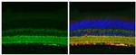 Tau Antibody in Immunohistochemistry (Paraffin) (IHC (P))