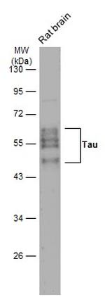 Tau Antibody in Western Blot (WB)