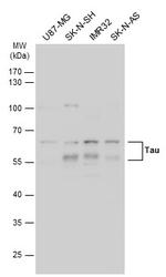 Tau Antibody in Western Blot (WB)