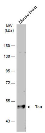 Tau Antibody in Western Blot (WB)