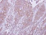 MyD88 Antibody in Immunohistochemistry (Paraffin) (IHC (P))