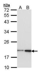 NME1 Antibody in Western Blot (WB)