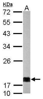 NME1 Antibody in Western Blot (WB)