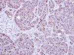 RPA70 Antibody in Immunohistochemistry (Paraffin) (IHC (P))