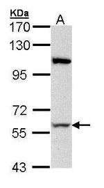 RPA70 Antibody in Western Blot (WB)