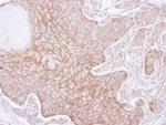 alpha Adducin Antibody in Immunohistochemistry (Paraffin) (IHC (P))