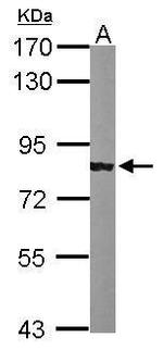 alpha Adducin Antibody in Western Blot (WB)