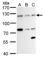 alpha Adducin Antibody in Western Blot (WB)