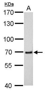 cIAP2 Antibody in Western Blot (WB)