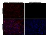 Arginase 1 Antibody in Immunohistochemistry (Paraffin) (IHC (P))