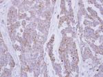 Catalase Antibody in Immunohistochemistry (Paraffin) (IHC (P))