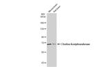 ChAT Antibody in Western Blot (WB)