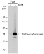 ChAT Antibody in Western Blot (WB)