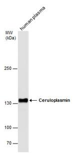 Ceruloplasmin Antibody in Western Blot (WB)