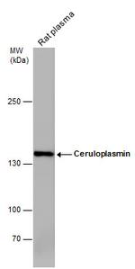 Ceruloplasmin Antibody in Western Blot (WB)