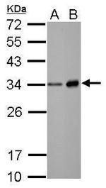 Neutrophil elastase Antibody in Western Blot (WB)