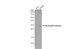 Neutrophil elastase Antibody in Western Blot (WB)