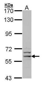 G6PD Antibody in Western Blot (WB)