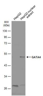 GATA4 Antibody in Western Blot (WB)