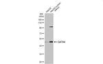 GATA4 Antibody in Western Blot (WB)