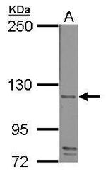 CD42b Antibody in Western Blot (WB)