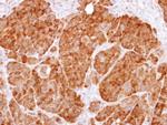 GPI Antibody in Immunohistochemistry (Paraffin) (IHC (P))