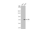 ITK Antibody in Western Blot (WB)