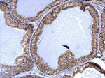 Cytokeratin 5 Antibody in Immunohistochemistry (Paraffin) (IHC (P))