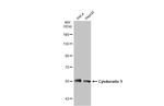 Cytokeratin 5 Antibody in Western Blot (WB)