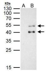 PBX1 Antibody in Immunoprecipitation (IP)