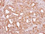 RAC2 Antibody in Immunohistochemistry (Paraffin) (IHC (P))