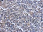 Vinculin Antibody in Immunohistochemistry (Paraffin) (IHC (P))