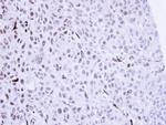 SMC1 Antibody in Immunohistochemistry (Paraffin) (IHC (P))