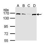 SMC1 Antibody in Western Blot (WB)