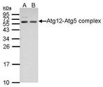 ATG5 Antibody in Western Blot (WB)