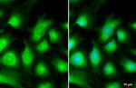 AKT3 Antibody in Immunocytochemistry (ICC/IF)