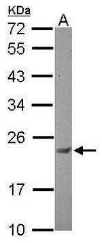 CK2 beta Antibody in Western Blot (WB)