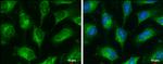 GRP78 Antibody in Immunocytochemistry (ICC/IF)