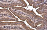 GRP78 Antibody in Immunohistochemistry (Paraffin) (IHC (P))