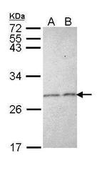 Stathmin 1 Antibody in Western Blot (WB)