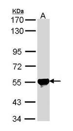 ALDH2 Antibody in Western Blot (WB)