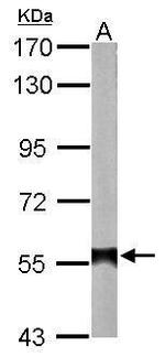 ALDH2 Antibody in Western Blot (WB)